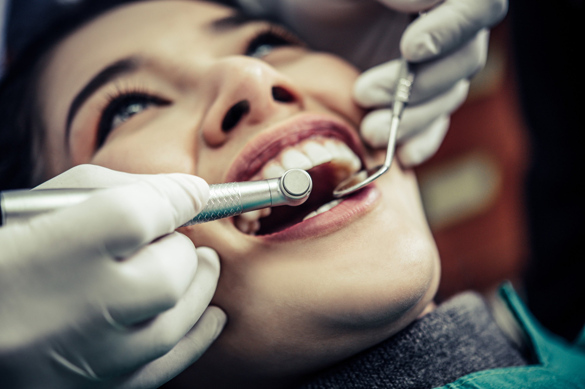 Teeth Whitening dental hospital bhimavaram
